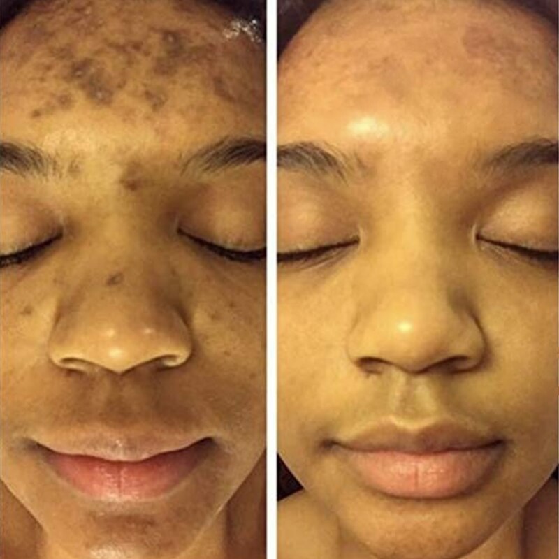 Organic Turmeric Brightening Facial Serum: Illuminate Your Skin Naturally